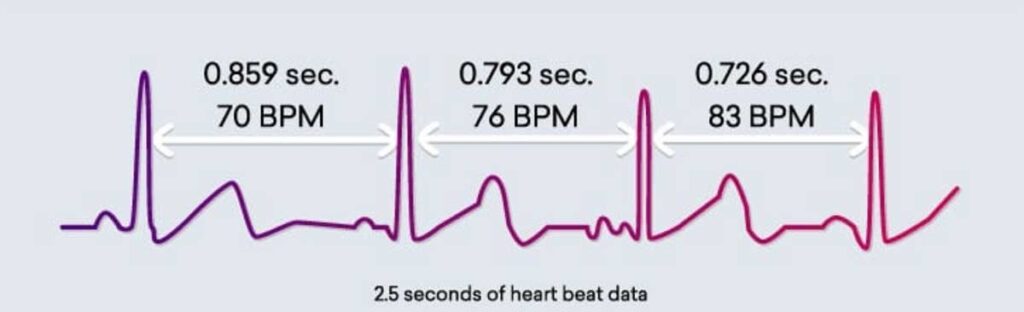 HRV Intervals